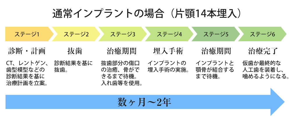 通常のインプラントと「All on 4」・「Pro Arch」の比較