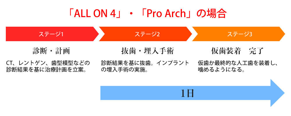 通常のインプラントと「All on 4」・「Pro Arch」の比較