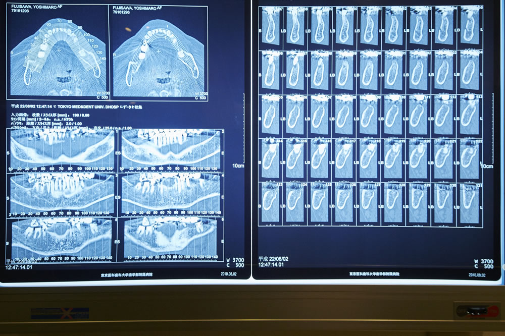 インプラント治療を行うための設備・体制