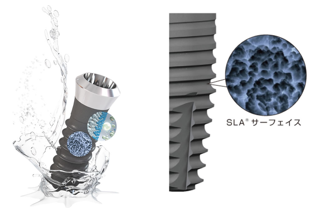 ストローマン独自の表面性状（SLA）