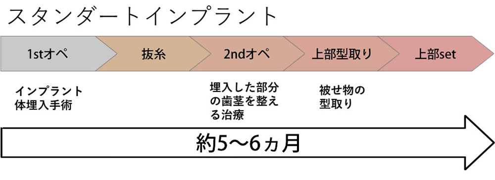 スタンダードインプラントの治療期間